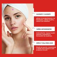 240Pcs Parches De Acné De Alta Gama Forma De Corazón Y Estrella Para Cubrir Erupciones Cutáneas Y Puntos Negros Parches Hidratantes Para El Rostro - details 1