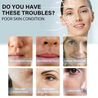 60Pcs Hilo De Colágeno Dorado Antienvejecimiento Lines Finas Antiarrugas Firmeza Facial Filler Absorbible Sin Agujas Serum De Cuidado De La Piel - details 4