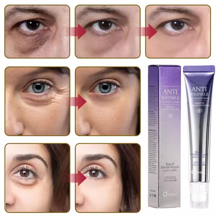 O`cheal Contorno de Ojos Anti-Ojeras 20g - 1