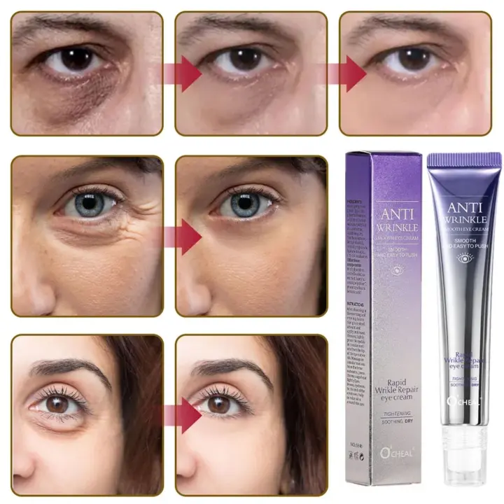 O`cheal Contorno de Ojos Anti-Ojeras 20g - 1
