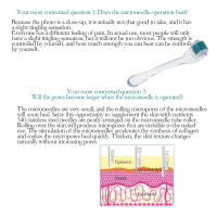 Derma Roller Profesional 540 Para Cuidado De La Piel Facial Y Corporal Crecimiento Del Vello Microneedle 0.2/0.25/0.3mm - details 7