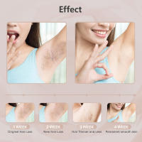 Epilador Láser Para Eliminación De Pelo 999999 Flashes Para Mujeres Y Hombres Eliminación De Pelo Corporal Piernas Axilas Bikini Facial Sin Dolor Depilador Láser Permanente - details 6