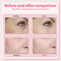 Láser Rojo Y Masajeador Facial 4 En 1 EMS Compresión Calefacción Vibration Rejuvenecimiento De Piel Esculturing Firmado Herramienta Para Ojos Y Cara - details 5