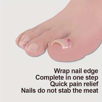 Herramienta De Corrección De Uñas Encarnadas Ingrediente Tratamiento De Uñas Del Pie Elástico Parche Clip Rectificador De Pedicura - details 5