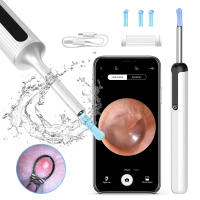 Endoscopio inalámbrico para eliminación de cera de oído, endoscopio seguro con cámara 1080P, otoscopio luminoso, herramientas de limpieza del oído - details 0