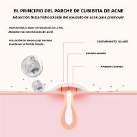 240Pcs Parches De Acné De Alta Gama Forma De Corazón Y Estrella Para Cubrir Erupciones Cutáneas Y Puntos Negros Parches Hidratantes Para El Rostro - details 3
