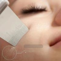 Máquina De Limpieza Profunda De Piel Ultrasonora Para Hombres Y Mujeres Instrumentos De Belleza Adecuados Para Limpieza De Poros - details 1