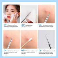 IMAGIC Set De 4 Piezas De Agujas De Acero Inoxidable Para Eliminación De Quistes Y Puntos Negros Limpieza De Poros Herramienta De Cuidado De La Piel Para El Rostro - details 3