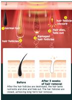 Epilador Laser IPL Para Mujeres Trimmer Afeitadora Remover Mower Afeitadora Eléctrica Bikinis Razor Gimnasio Máquina De Corte De Pelo - details 2