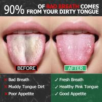 Juego De Limpieza De Lengua En Acero Inoxidable Premium Herramienta De Higiene Oral Portátil Para Viajes Elimina El Aliento Malo - details 4