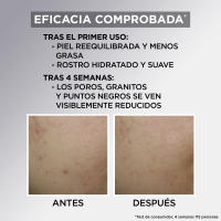 Garnier Pure Active Crema Hidratante Matificante con AHA+BHA+ Carbón para pieles con tendencia acneica - details 0