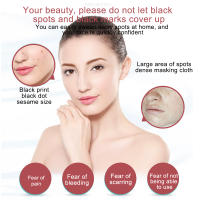 Plasma Pen Herramienta De Belleza Para Eliminar Vainillas Manchas De Piel Nevo Y Tatuajes Con LCD 9 Niveles USB Cable - details 6