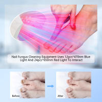 Dispositivo De Láser Para Uñas 20W Carga Inalámbrica Pantalla Digital Luz Roja 24*650NM + Luz Azul 12*470NM Para Limpieza De Onicomicosis Jitesy S15 - details 2