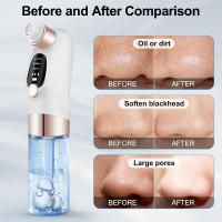 Limpiador De Puntos Negros USB Recargable Suction Vacío Facial Extractor De Comedones Quimono Negro Para Limpieza De Rostro - details 7