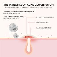 240Pcs Parches De Acné De Alta Gama Forma Corazón/Estrella Para Cubrir Espinillas Y Manchas Hidratantes Pack De Cuidado Facial - details 3