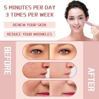 Masaje EMS para Ojos Vibración Facial Cuidado DE LA PIEL - details 9