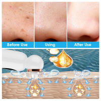Limpiador de Poros Electrico Succionador, Limpiador Facial Ajustable de 3 Modos, Equipado con 6 Cabezales de Succión Reemplazables, Limpiador Facial con Pantalla LED, Adecuado para Hombres y Mujeres, san valentin regalos mujer - details 3