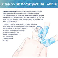 Sanke Kit De Primeros Auxilios IFAK Para Trauma De Tórax Con Aguja De Neumotórax Y Catéter Decompresión Edc Necesario Para La Supervivencia En Emergencias - details 1