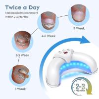 Dispositivo de tratamiento láser de los colores en las uñas para múltiples uñas, use en el hogar 910nm Luz infrarroja + 470Nm Luz Azul uñas - details 1