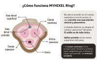 MYHIXEL, Anillo de Silicona para el Pene, Diseño Médico para Prolongar y Mantener Erecciones, Sin Efectos Secundarios, Cómodo y Adaptable, Duradero, Tres Modelos, Elige el que Mejor se Adapte a tus Necesidades, Light, Firm o Intense - details 4