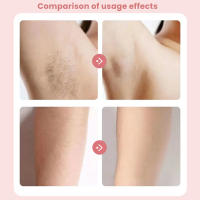 Epilador Eléctrico Profesional Para Mujer Peluca Facial Bikini Axilas Piernas Cuerpo Impermeable Recargable Herramienta De Belleza - details 3