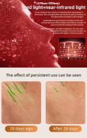 Máscara De Luz Roja LED Para Terapia De Piel Con 480 Lámparas De 4 Colores Ajustables Silicone Material Para Belleza Del Cuello Y Cuidado De La Piel - details 4