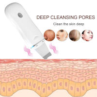 Paleta de Limpieza facial Skin Scrubber ultrasónica Cuidado en casa Depurador o Depuracion profunda de la piel Tratamiento de arrugas Eliminación de impurezas Piel rejuvenecida Exfoliación suave Piel más suave - details 0