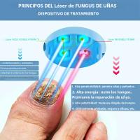 Dispositivo de tratamiento láser para hongos en las uñas, reparación de hongos en las uñas de los pies, tratamiento de onicomicosis, relajación de hongos - details 2