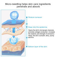 DRS 540 Micro Aguja Roller Derma Facial Herramienta De Belleza Para Regeneración Del Cabello Barba Reducción De Arrugas Eliminación De Marcas Blanqueamiento - details 9