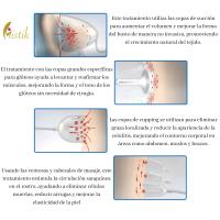 MISTIK  Máquina Terapia Vacío Aumento Senos Levantamiento Glúteos Cupping Adelgazamiento Corporal Reafirmante Piel Desintoxicación Linfática Equipo Masaje Anti Celulitis Equipo Belleza Facial Profesional Cuidado Piel Mistik Beauty Madrid - details 1