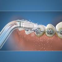 Waterpik, Boquillas de ortodoncia y Boquillas de irrigación. - details 1