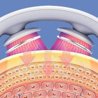 Masajeador Cervical Portátil Mini Masajeador De Hombros Profundo Con Calor Para El Cuello Cuidado De La Salud Estirador De Cuello - details 1