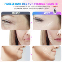 Dispositivo De Belleza Para El Cuello 3 Colores EMS Masajeador Facial Levantamiento Antiarrugas LED Fotón Eliminador De Doble Mentón Rejuvenecimiento De La Piel - details 6