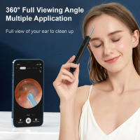 Endoscopio inalámbrico para eliminación de cera de oído, endoscopio seguro con cámara 1080P, otoscopio luminoso, herramientas de limpieza del oído - details 1