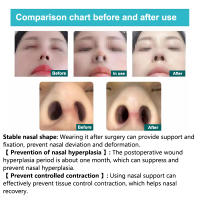 1PCS Soporte De Silicona Para Nariz Postoperatorio Después De La Rhinoplastia Aplicador De Forma Para Corregir Nariz Torcida Fijador De Nariz Clip De Gel De Silicio - details 5
