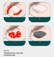 Juego De Tijeras Para Uñas De Acero Inoxidable Herramientas De Manicura Y Pedicura Incluye Tijeras Para Uñas Alicate De Cutícula Y Herramienta De Empuñadura De Cutícula - details 5