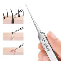 Tijeras Para Eliminar Quistes De Acné De Acero Inoxidable Herramientas Eficientes Para Extracción De Comedones Y Quistes Blancos Limpieza Profunda Del Piel - details 0