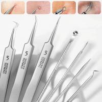 Aguja De Acné Ultra-fina Número 5 Alemana Para Eliminar Blackheads Y Puntos Negros Herramienta Especial De Belleza Para El Rostro Uso En Salones De Salud - details 1