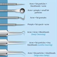 Kit De 8 Piezas Para Eliminar Quistes Y Acné Herramientas De Extracción Profesionales De Acero Inoxidable Para Todas Las Tipos De Piel Set De Popper De Puntos Negros - details 1