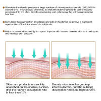 ZGTS Derma Roller De 540 Agujas Para El Rostro Y El Cuerpo Cuidado De La Piel Y Crecimiento Del Vello Profesional Herramienta De Belleza Microneedle Roller - details 4