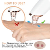 Limpieza Facial Profunda Máquina Exterminadora De Puntos Negros Eléctrica Limpiador De Poros Apto Para Todas Las Edades Herramienta De Cuidado De La Piel - details 2