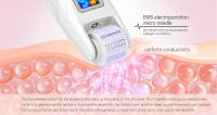 Hello Face EMS Titanium Derma Roller 540 Agujas Rejuvenecimiento Colágeno Micro Corriente Vibración LED Con 2 Cabezales De Rodillo - details 4
