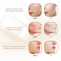 Máscara Facial De Silicona LED 3D Con Terapia De Luz Roja Para Belleza Y Cuidado De La Piel 7 Colores Reparación Y Blanchimente Sin Cable - details 16