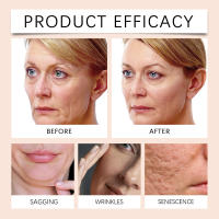 Barra de esencia Hoygi, barra de esencia reafirmante para la piel, hidratante suave, reafirmante, para el cuidado del contorno facial y del cuello. - details 4