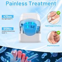 Dispositivo de Tratamiento de Hongos en las Uñas, Aparato de Tratamiento Láser de Hongos de Uñas Hongos de Uñas de Los pies Limpieza Reparación de Uñas Tratamiento de Hongos de Uñas. - details 3