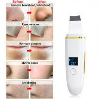 Limpieza Facial Profunda Con Scraper Ultrasonido Eliminador De Acné Y Arrugas Rejuvenecimiento De Piel USB Recargable Plástico - details 8