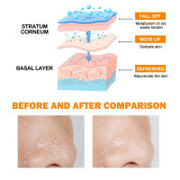 Gel exfoliante para puntos negros Hoygi Exfolia suavemente los puntos negros, reduce los poros, ilumina y suaviza la piel. - details 6