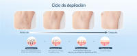 3 en 1 Depiladora de Luz Pulsada IPL con Función de Enfriamiento,HR/RA/SC,9 Nivel de Energía,999.990 Luz Pulsada,Depiladora Láser Confort Para Piernas,Bikini, Axilas, Cara, Cuerpo visión nocturna - details 3