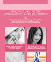 Potente dispositivo eléctrico de succión de puntos negros para eliminar puntos negros y puntos blancos, reducir el acné, limpiar los poros, dispositivo de burbujas pequeñas de belleza facial - details 2