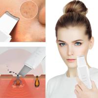 Limpiador Facial Vibratorio Profundo Skin Scrubber No Ultrasonido Espátula Exfoliante Eliminador De Quimiotacto Masajeador Facial - details 1